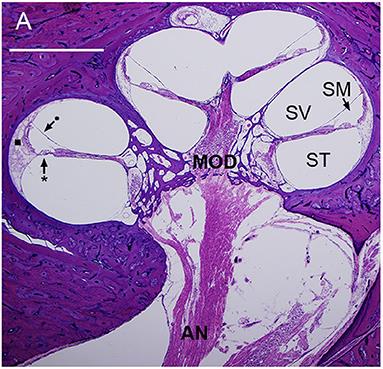 On the Role of Fibrocytes and the Extracellular Matrix in the Physiology and Pathophysiology of the Spiral Ligament